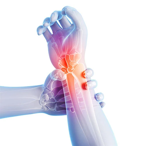 Darstellung der peripheren Nerven - Symbolbild für die neurochirurgische Therapie durch Prof. Dr. Reza Akhavan-Sigari in Bremen