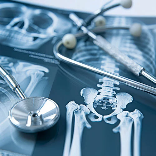 Visualisierung der Wirbelsäule - Symbolbild für die Wirbelsäulenchirurgie bei Prof. Dr. Reza Akhavan-Sigari in Bremen